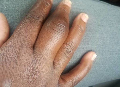 https://denticare.bold-themes.com/oscar/wp-content/uploads/sites/15/2020/01/post-03-1280x1280.jpg